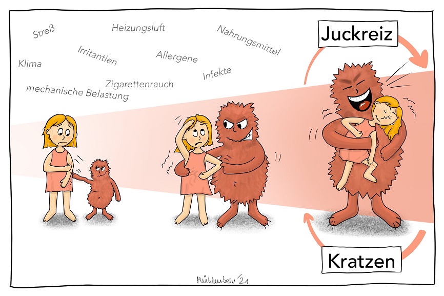 Eine Illustration die zeigt wie der Juckreiz von Umwelteinflüssen begünstigt wird. 